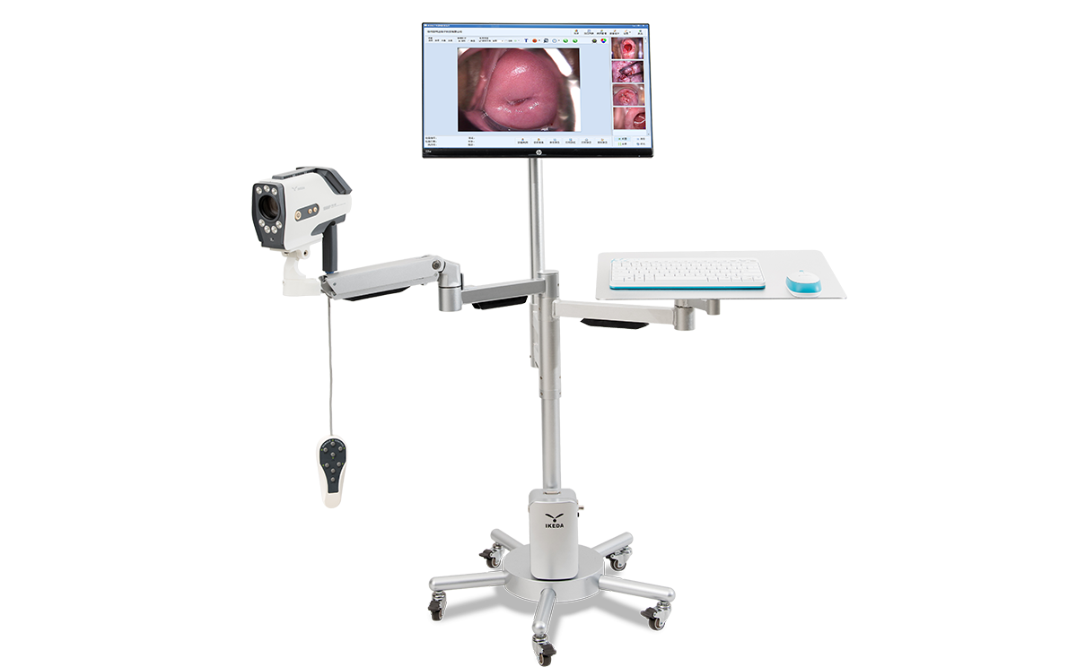 數碼電子陰道鏡如何選擇?根據醫院等級需求選擇合適的 數碼電子陰道鏡如何選擇?根據醫院等級需求選擇合適的
