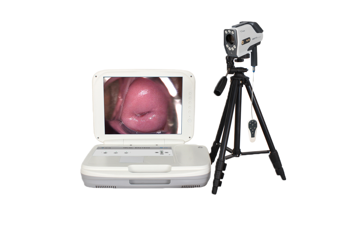 數碼電子陰道鏡如何選擇?根據醫院等級需求選擇合適的 數碼電子陰道鏡如何選擇?根據醫院等級需求選擇合適的