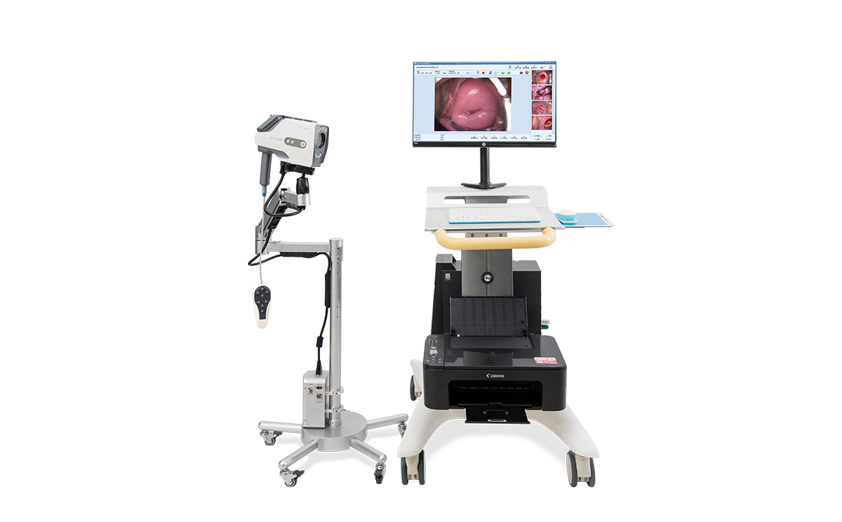 數碼電子陰道鏡如何選擇?根據醫院等級需求選擇合適的 數碼電子陰道鏡如何選擇?根據醫院等級需求選擇合適的