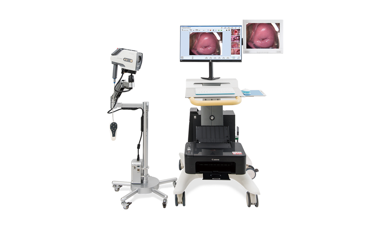 數碼電子陰道鏡如何選擇?根據醫院等級需求選擇合適的 數碼電子陰道鏡如何選擇?根據醫院等級需求選擇合適的