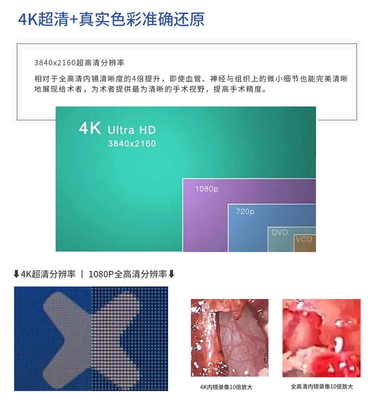 【4K醫用內窺鏡攝像系統】您的第一臺“4K”找到了嗎? 【4K醫用內窺鏡攝像系統】您的第一臺“4K”找到了嗎?