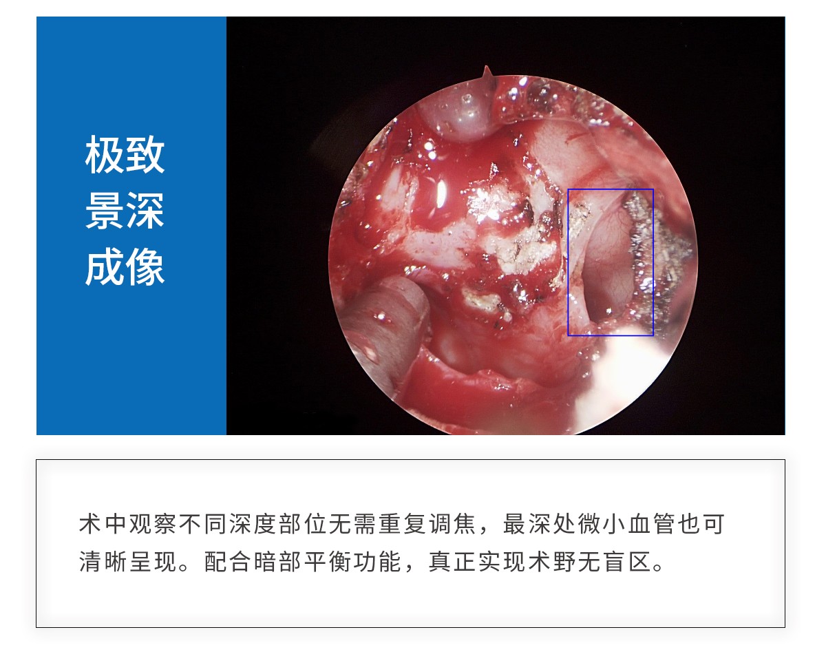 【4K醫用內窺鏡攝像系統】您的第一臺“4K”找到了嗎? 【4K醫用內窺鏡攝像系統】您的第一臺“4K”找到了嗎?