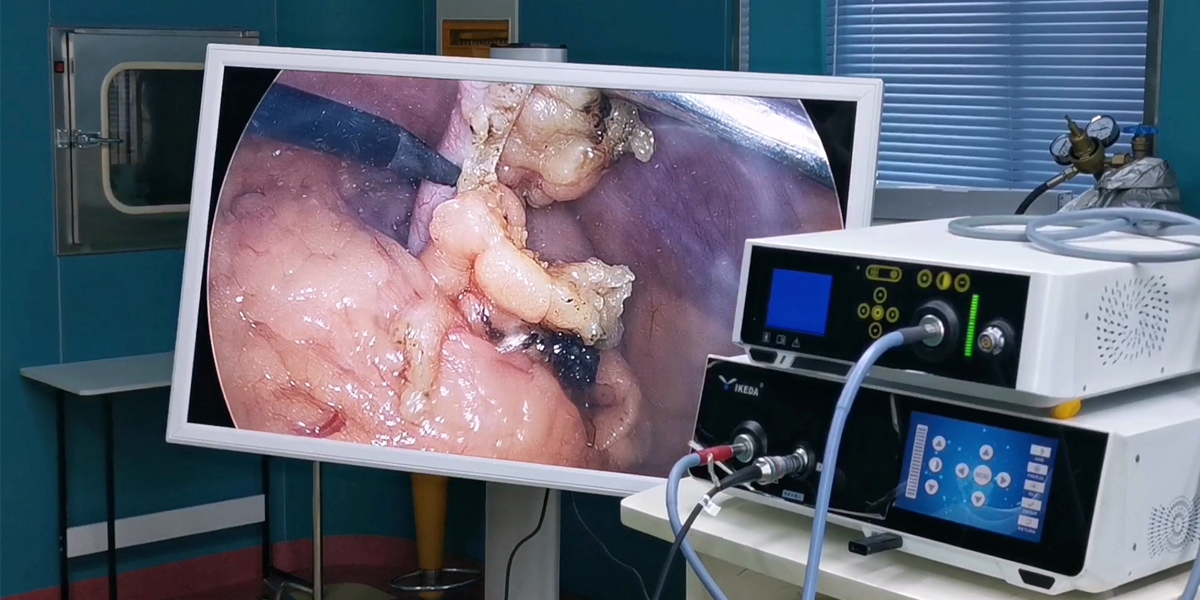 【4K醫用內窺鏡攝像系統】您的第一臺“4K”找到了嗎? 【4K醫用內窺鏡攝像系統】您的第一臺“4K”找到了嗎?