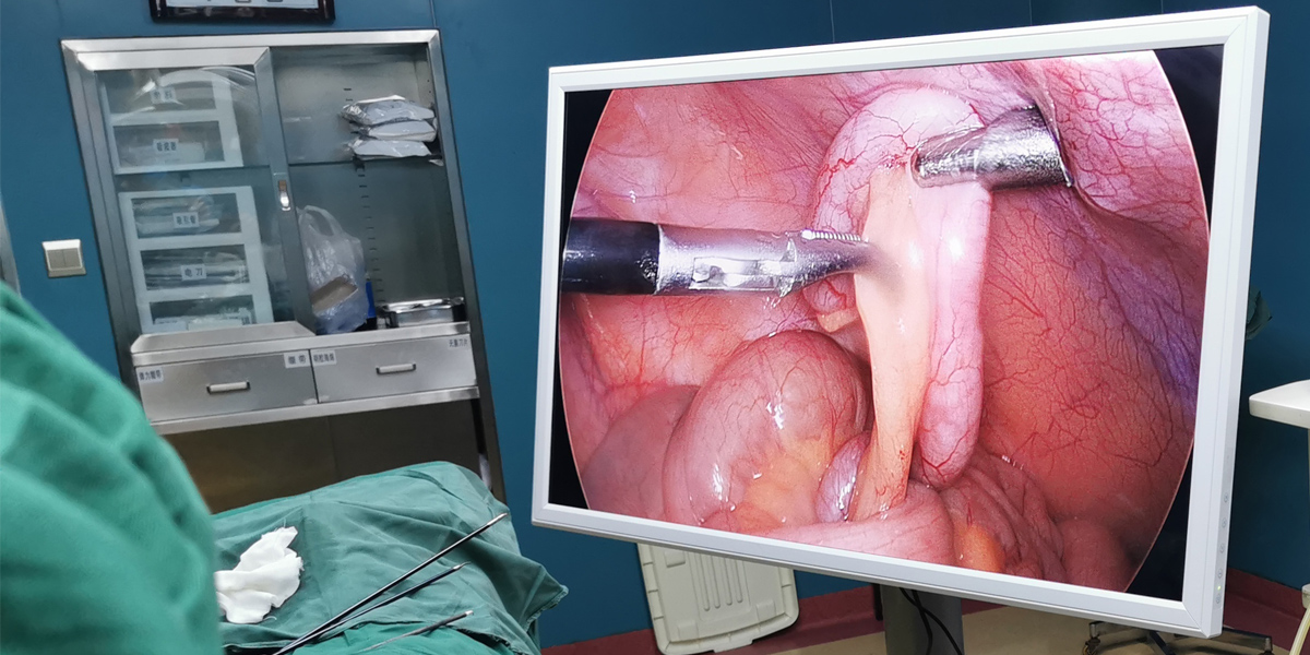 【4K醫用內窺鏡攝像系統】您的第一臺“4K”找到了嗎? 【4K醫用內窺鏡攝像系統】您的第一臺“4K”找到了嗎?