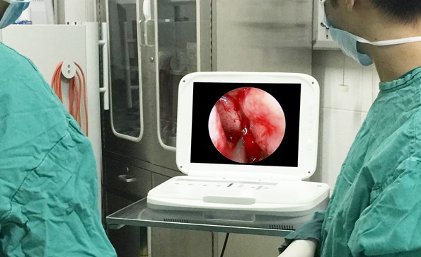 耳鼻喉科內窺鏡檢查痛嗎？